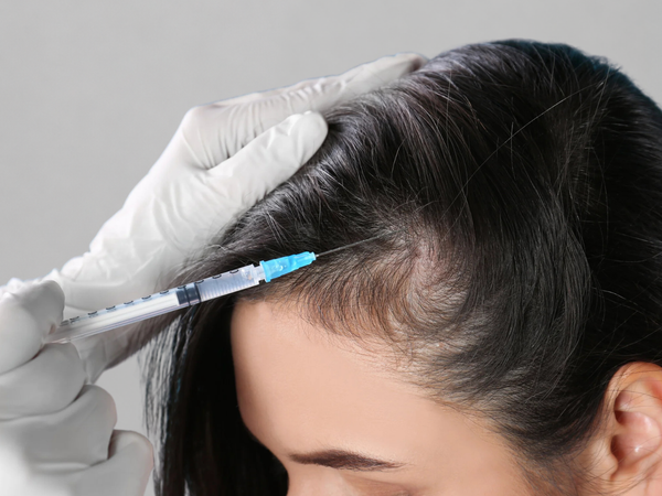 PRP Therapy