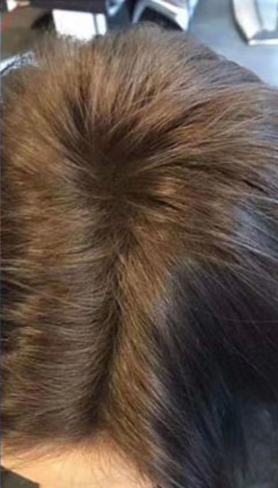 After